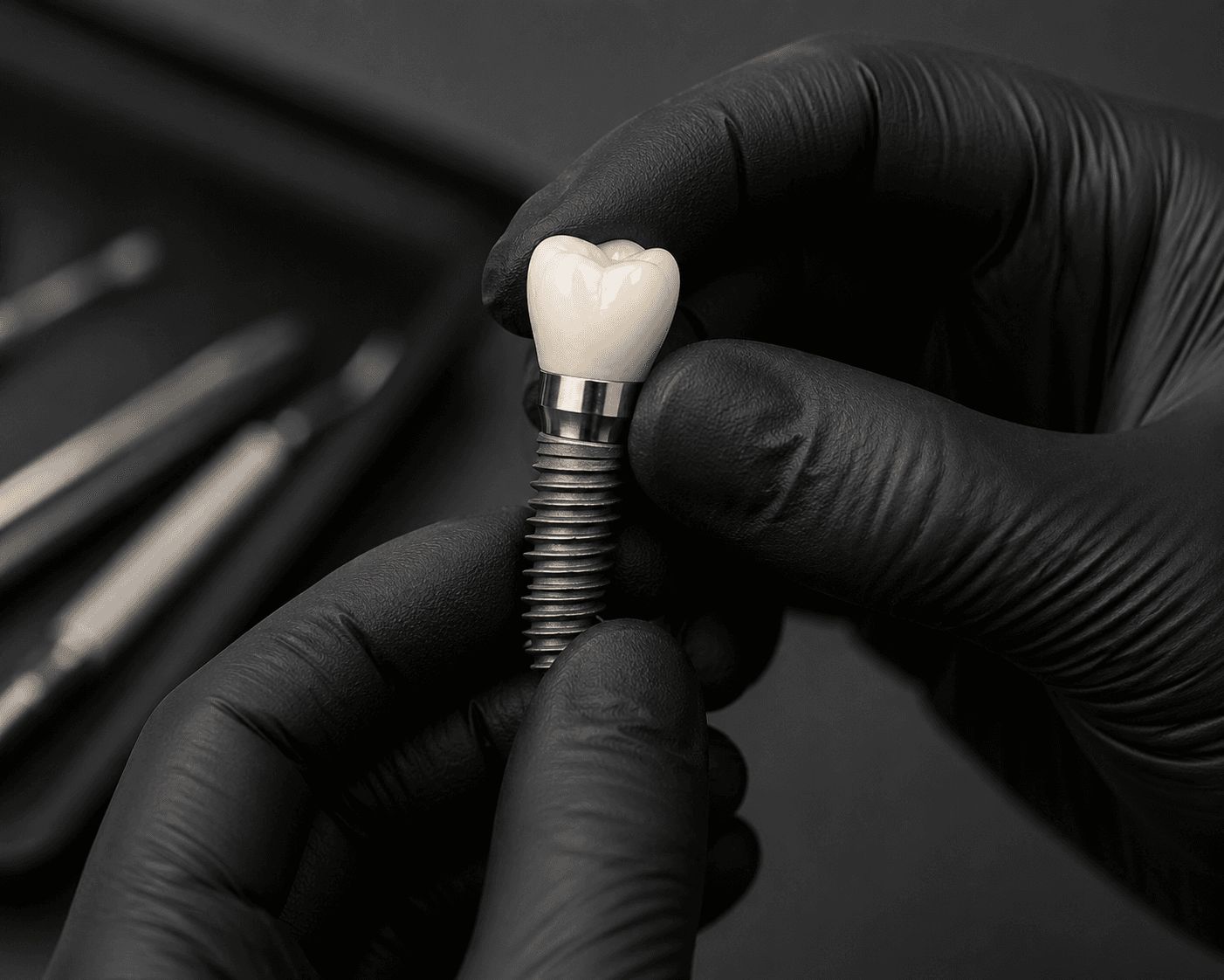 Implante dental de titanio con corona cerámica, sostenido con instrumental clínico